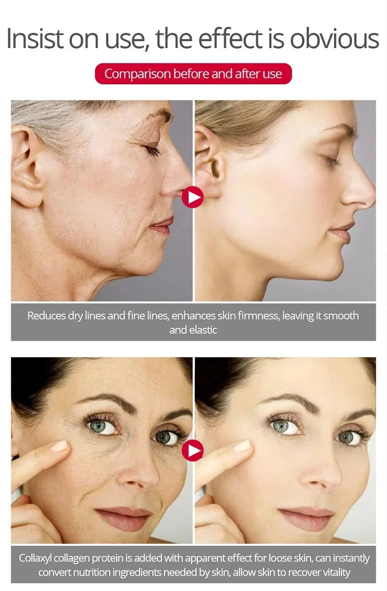 Retinol Wrinkle Removal Face Cream Anti-Aging Firming Lifting Fade Fine Lines Products Moisturizing Brighten Repair Skin Care