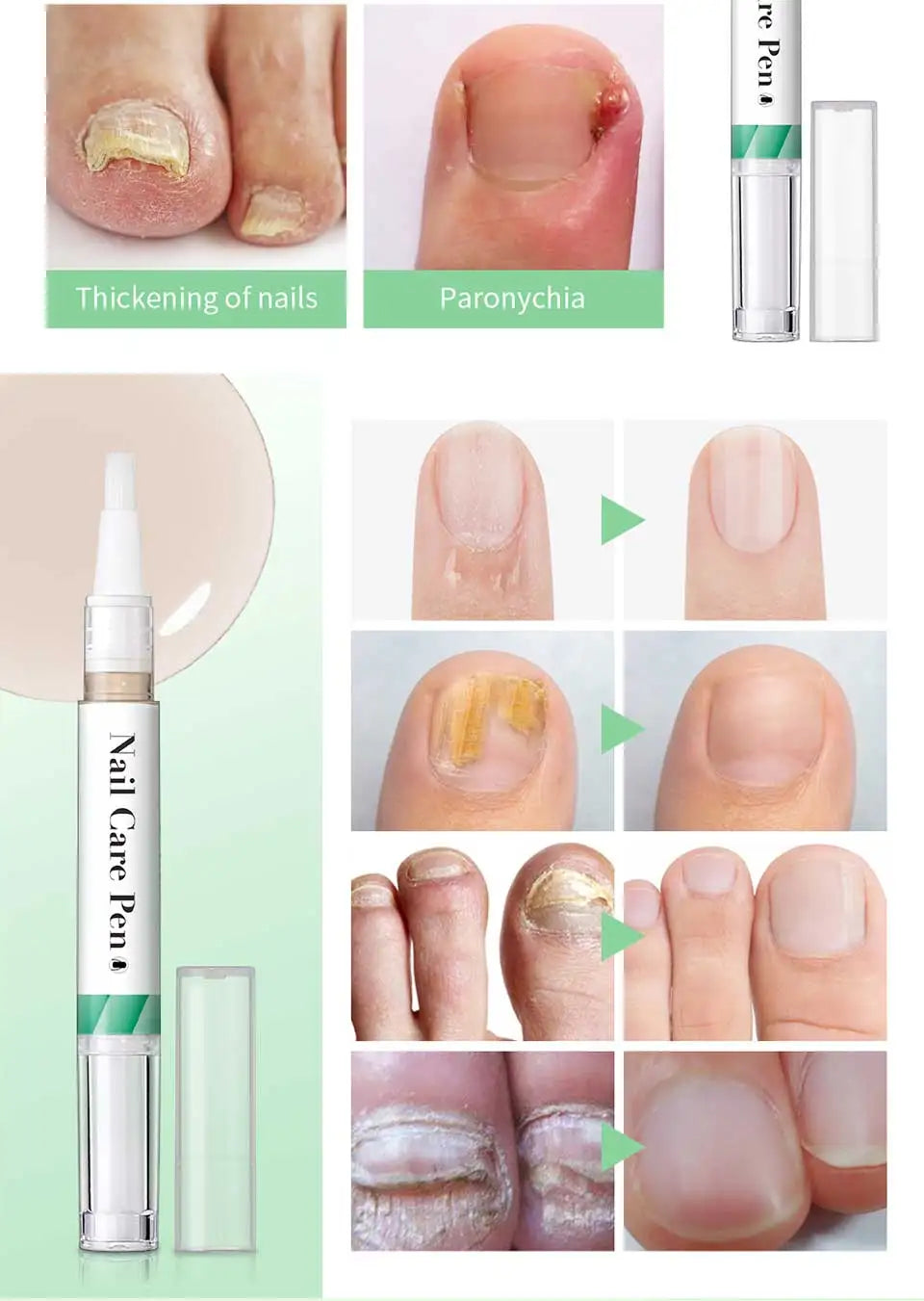 Nail Care Pen Nourish and Moisturize Nails Prevent Fungal Infections Improve Appearance Flat Brush Head Design Daily Nail Care