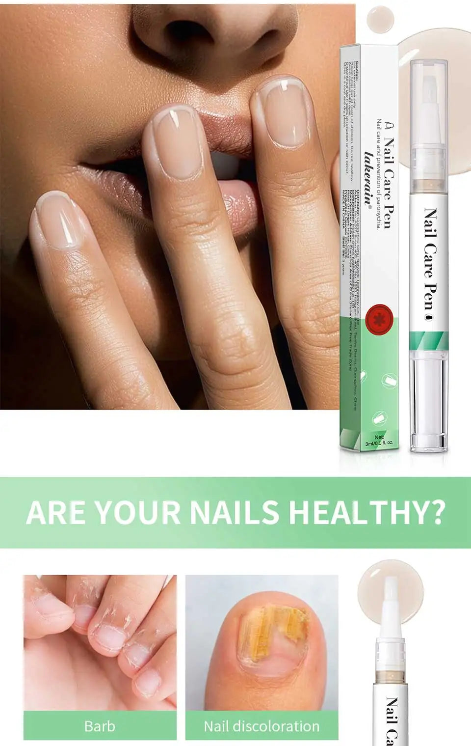Nail Care Pen Nourish and Moisturize Nails Prevent Fungal Infections Improve Appearance Flat Brush Head Design Daily Nail Care