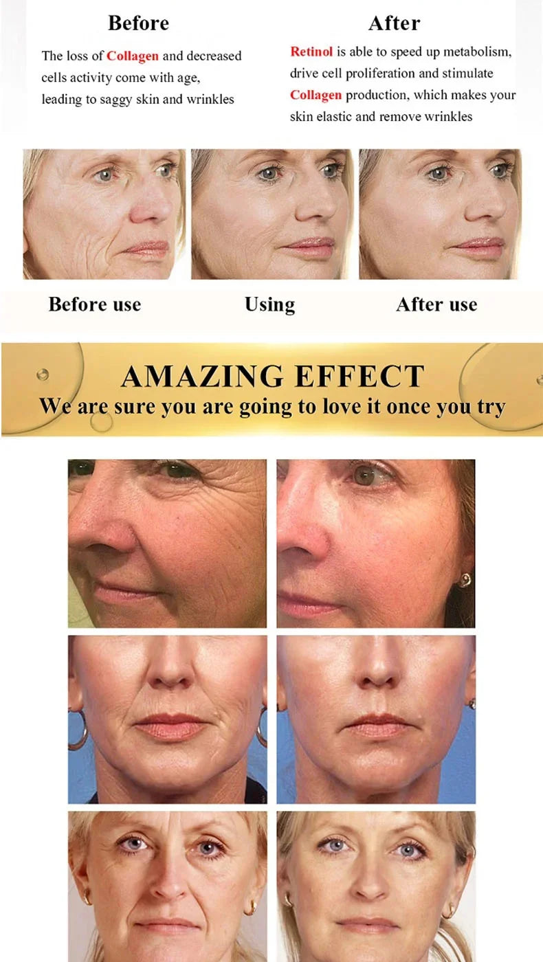 Retinol Wrinkle Removal Face Cream Anti-Aging Firming Lifting Fade Fine Lines Products Moisturizing Brighten Repair Skin Care