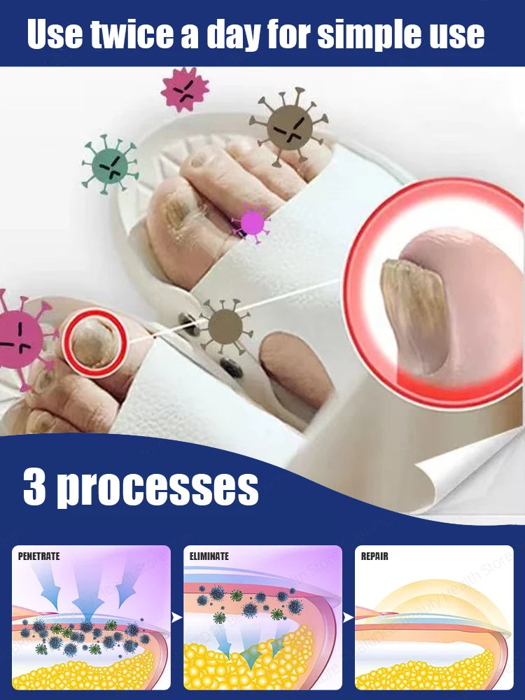 High-quality blue ʟɪɢʜᴛ ғᴏʀ ɴᴀɪʟ ғᴜɴɢɪ promotes healthy and beautiful nails.