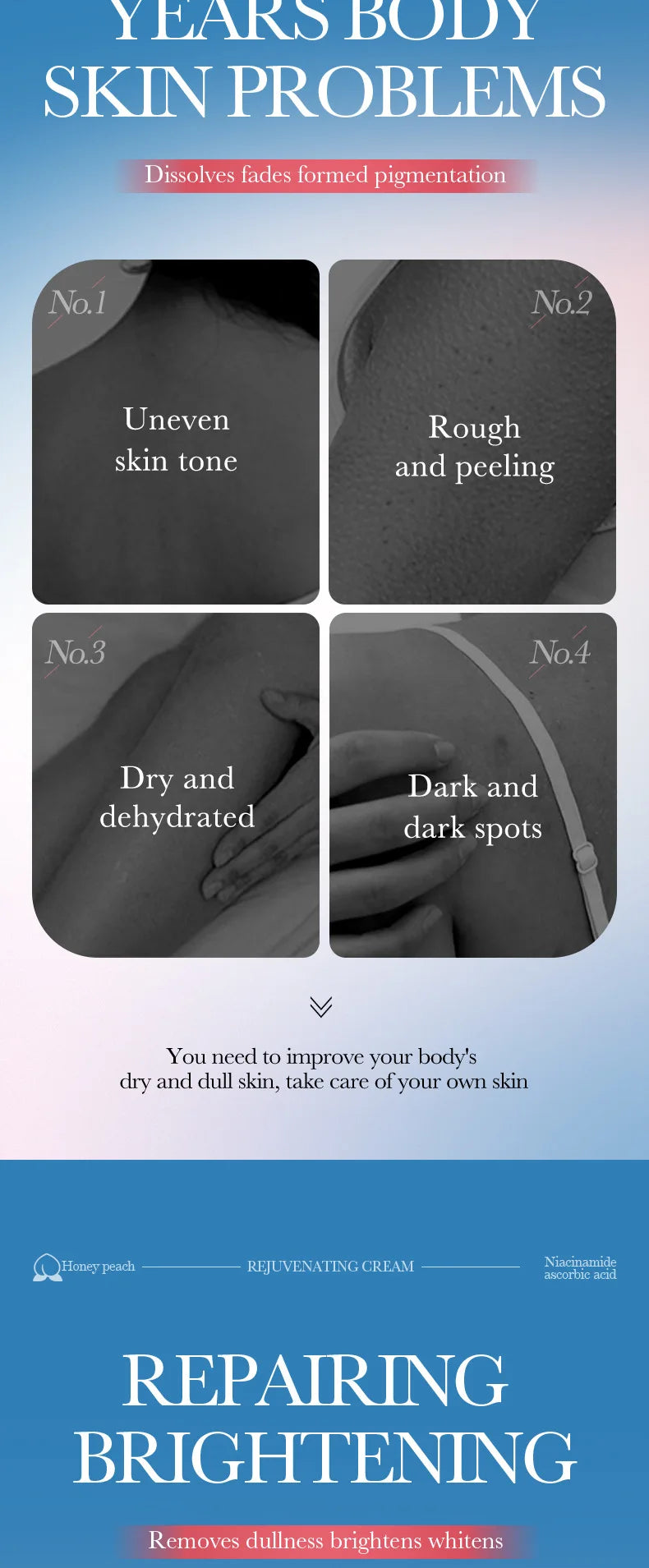 Body Whitening Cream Dark Skin Armpit Lightening Intimate Areas Underarm Bleaching Private Parts Whiten Cream Body Lotion Beauty